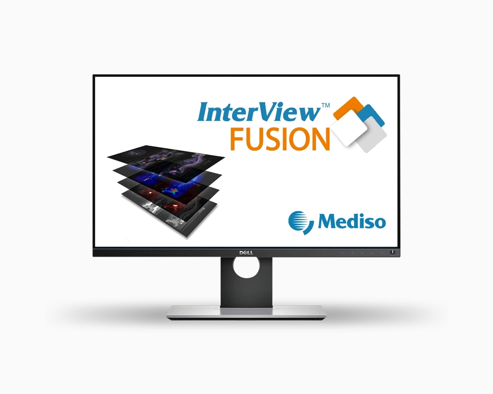 利用Mediso美迪索AnyScan® PET/CT，基于体内放射组学和临床参数精准预测DLBCL患