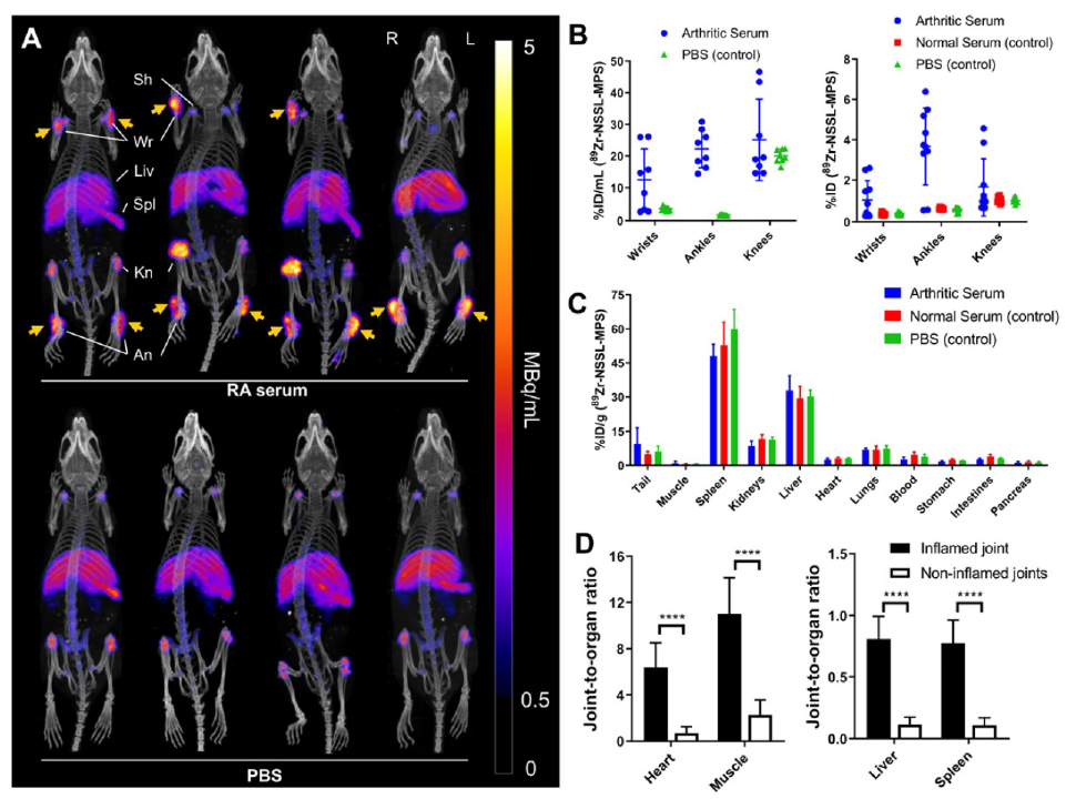 使用89Zr - oxine对脂质体糖皮质激素PET成像：炎症性关节炎诊疗应用及Mediso美迪索n